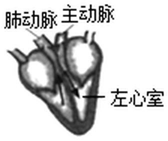 arc_q11_B.jpg