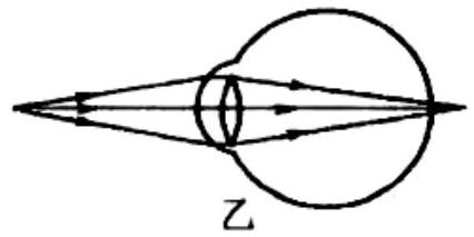 mp_aea300f3cf.jpg